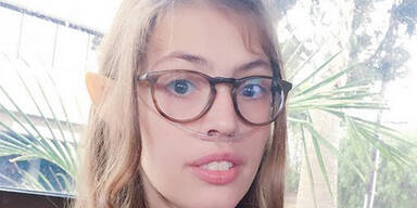 Youtube-Star stirbt nach Lungentransplantation