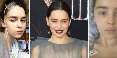 Emilia Clarke GoT