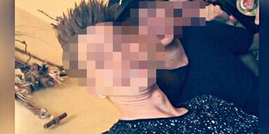 "Horror-Clown schlug mich nieder"