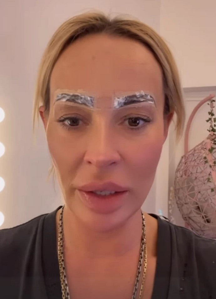 Cora Schumacher: Beauty-Fail vor Dschungel