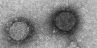 So sieht das '&ouml;sterreichische' Coronavirus aus