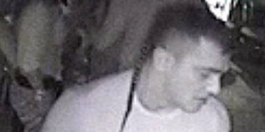 Angezündete Prostituierte verlässt AKH