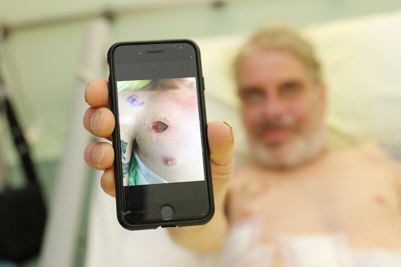 Mann von Zaunstange gepfählt