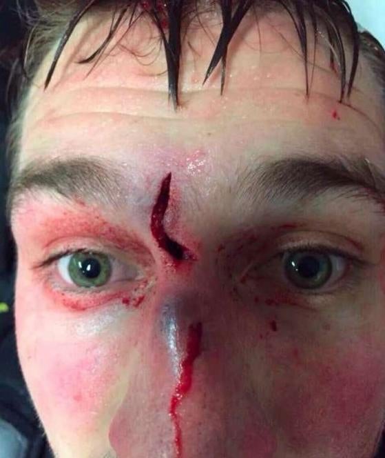 Eishockey-Star postet Horror-Selfie