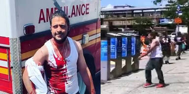 Mann spaziert mit Messer im Kopf blut&uuml;berstr&ouml;mt durch die Stadt