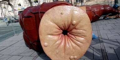 Riesen-Darmausgang schockt die Wiener