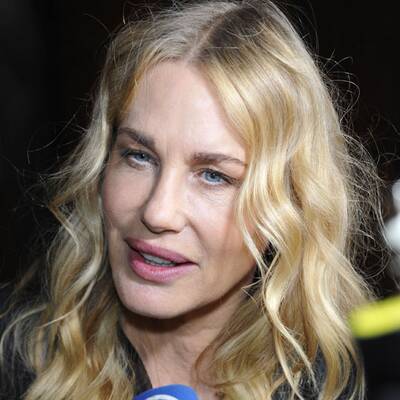 Wer hat Hollywoods schlimmste OP-Fratze?