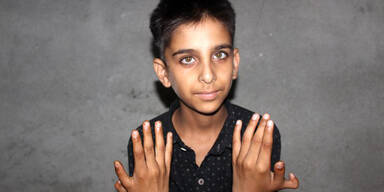 Junge hat vier Daumen - und gewinnt damit jedes Videospiel