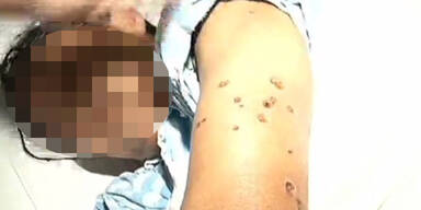 Wespen-Attacke auf Beerdigung: Drei Tote