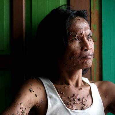 Baum-Mann Dede Kosiwara