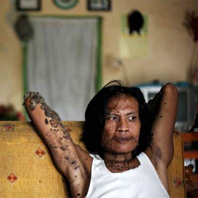 Baum-Mann Dede Kosiwara