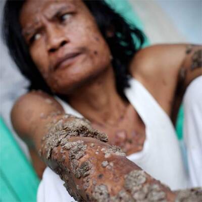 Baum-Mann Dede Kosiwara