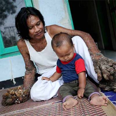 Baum-Mann Dede Kosiwara