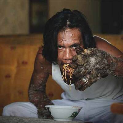 Baum-Mann Dede Kosiwara