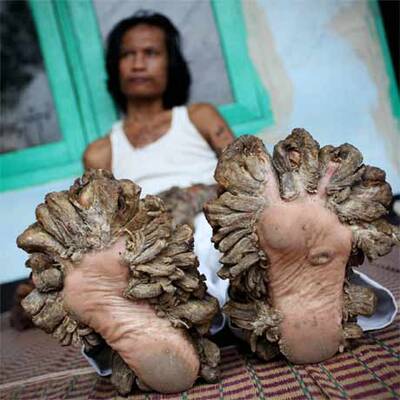 Baum-Mann Dede Kosiwara