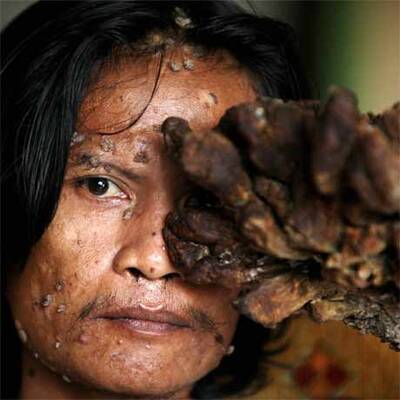 Baum-Mann Dede Kosiwara