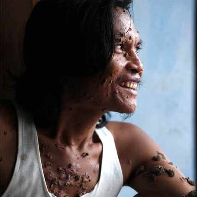 Baum-Mann Dede Kosiwara