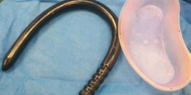 Mit Sex-Spielzeug eigenen Darm zerst&ouml;rt