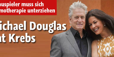 Michael Douglas hat Tumor im Hals