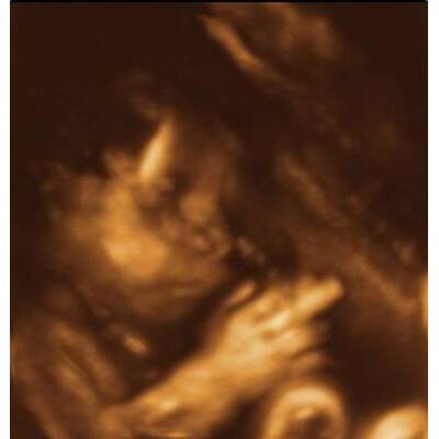 Babys im Bauch: Die witzigsten Bilder