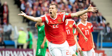 Trikot-Panne sorgt f&uuml;r Wirbel in Russland