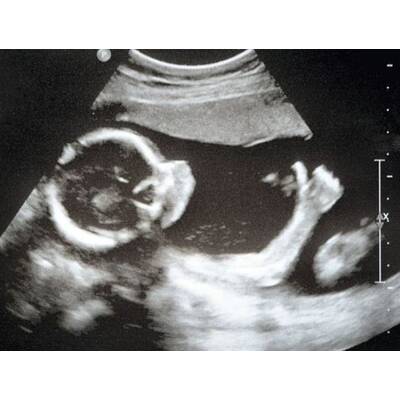 Babys im Bauch: Die witzigsten Bilder