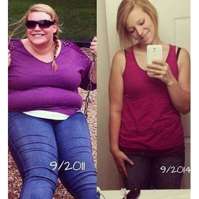 Beeindruckende Vorher-/Nacher-Bilder