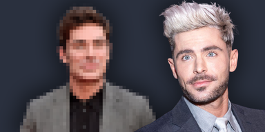 Verpfuschte Sch&ouml;nheits-OP bei Zac Efron?