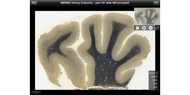 Einsteins Gehirn als App für das iPad