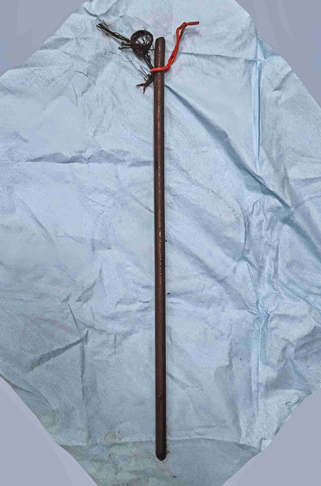 59-Jähriger von Eisenstange durchbohrt