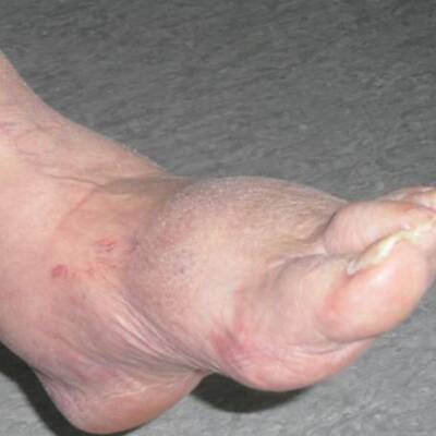 Elsner im Krankenhaus