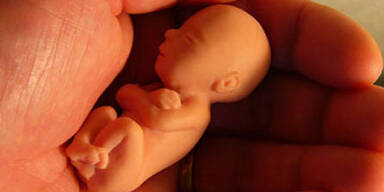 embryo