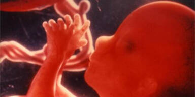 embryo_apa