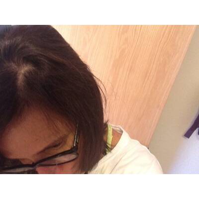 Promi-Shampoo verursacht Haarausfall