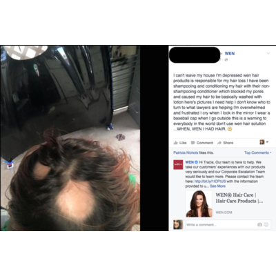 Promi-Shampoo verursacht Haarausfall