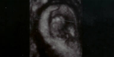 Fötus Internet Abstimmung Alisha Pete Arnold