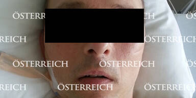 Polizei identifiziert Fassadenphantom