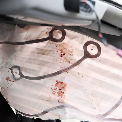 Schwerer Unfall von Fasslabend