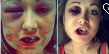 Keine Lust auf Sex: Mann verpr&uuml;gelt seine Freundin