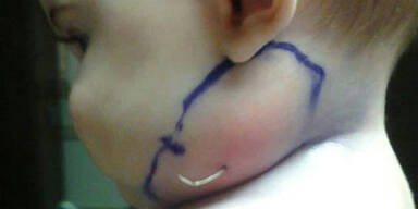 Baby wächst Feder aus dem Hals