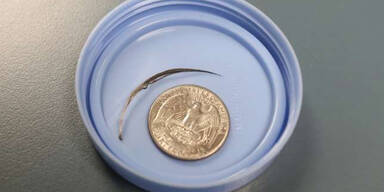 Baby wächst Feder aus dem Hals