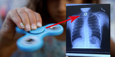 Horror-Foto schockt Fidget-Spinner-Nutzer