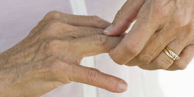 Warum knacken manche Finger?