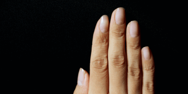 Streifen unter Fingernagel entpuppt sich als Krebs