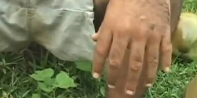 12 Finger 12 Zehen