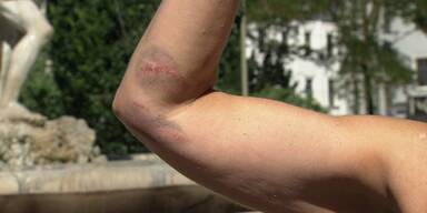 Urlauberin bei Fischattacke im W&ouml;rthersee verletzt