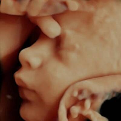 3D-Fotos aus der Gebährumutter