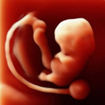 3D-Fotos aus der Gebährumutter