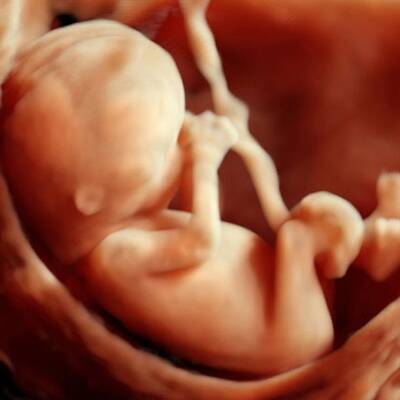 3D-Fotos aus der Gebährumutter