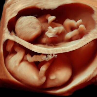 3D-Fotos aus der Gebährumutter